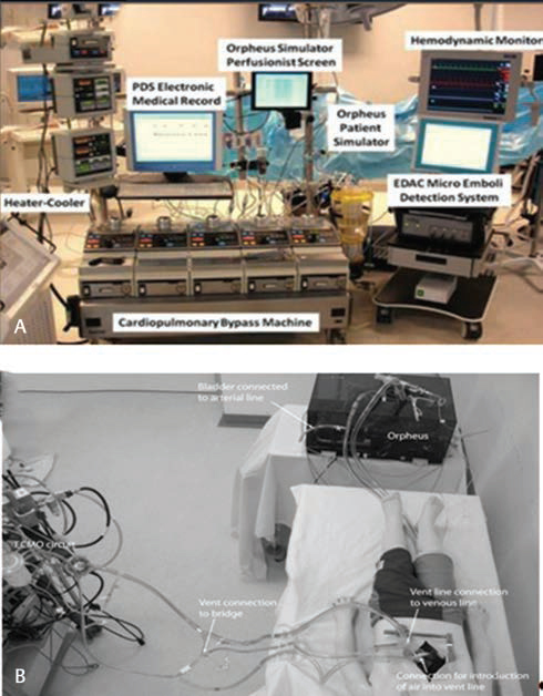 (A, B) The system is made up of the Orpheus perfusion simulator incorporating a modified resuscitation mannequin between the hydraulic module of the Orpheus and the extracorporeal membrane oxygenation system.