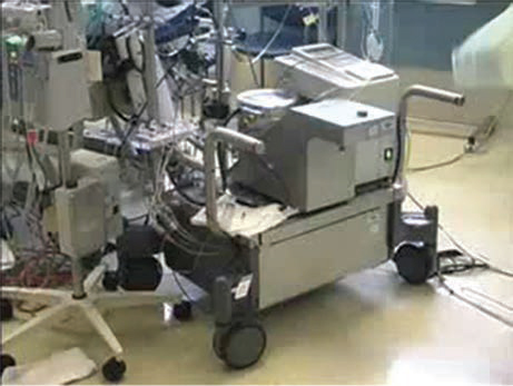 Extracorporeal membrane oxygenation setup in the operating room.