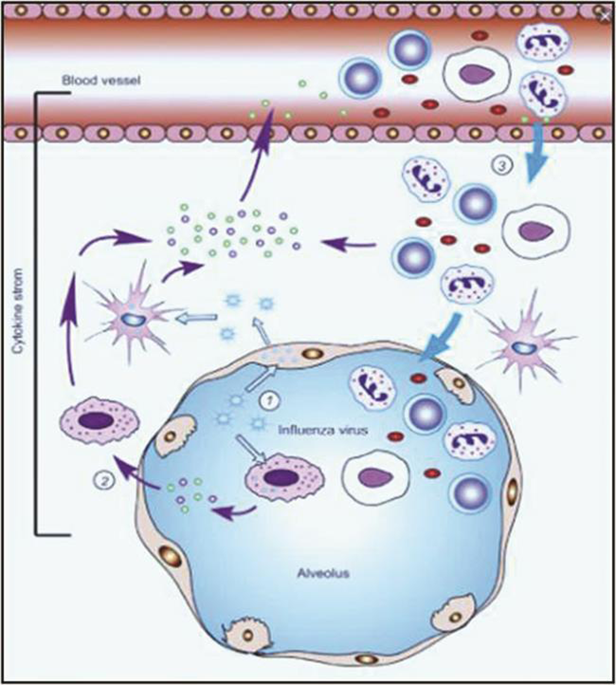 Cytokine storm is the root of the problem.