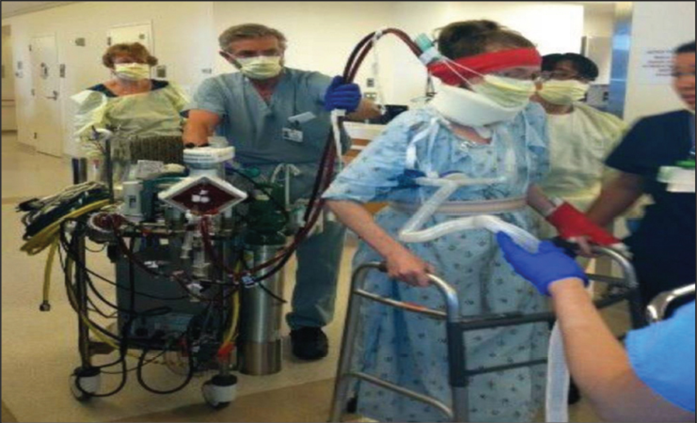 A patient walking with extracorporeal membrane oxygenation (ECMO) machine in the ICU.