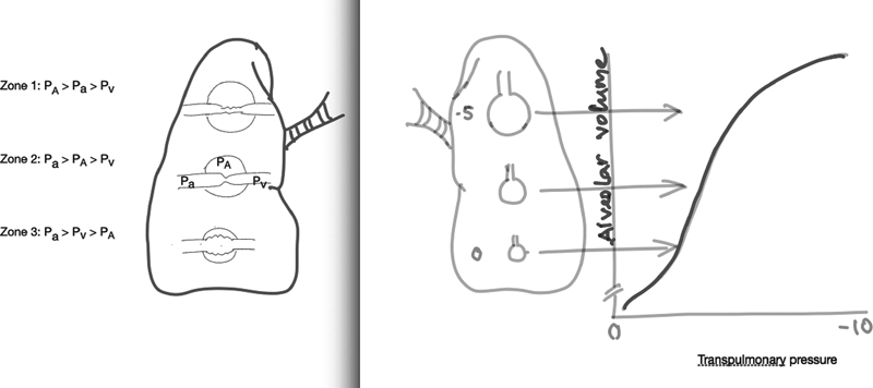 Distribution of perfusion is depicted in upright position by the three-zone model (A); right panel showing the effect of gravity on transpulmonary pressure in a healthy individual affecting the alveolar compliance (B). This effect is exaggerated in acute respiratory distress syndrome (ARDS) due to increasing mass of inflamed and edematous lung (due to the hydrostatic pressure imposed by the weight of the affected tissue) toward the dependent region. PA, alveolar pressure; Pa, arterial pressure; Pv, venous pressure.