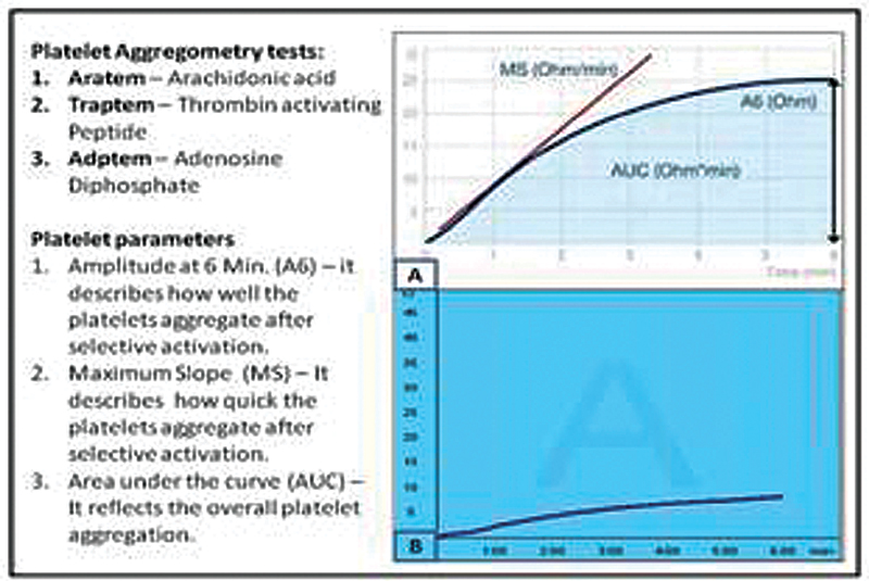 Rotational thromboelastometry platelet activators and parameters: (A) Normal platelet function test (PFT) and (B) decreased PFT—hyperfibrinolysis.