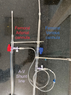 A shunt line connection between arterial and venous lines of the standby ECMO circuit keeping most of the circuit in circulation.