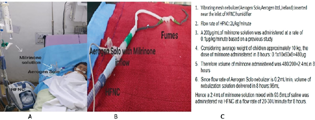 (A) Assembly for administering inhaled milrinone via high-frequency nasal cannula (HFNC). (B) Aerosolization of milrinone solution. (C) Calculation of dosage and volume of milrinone solution administered.