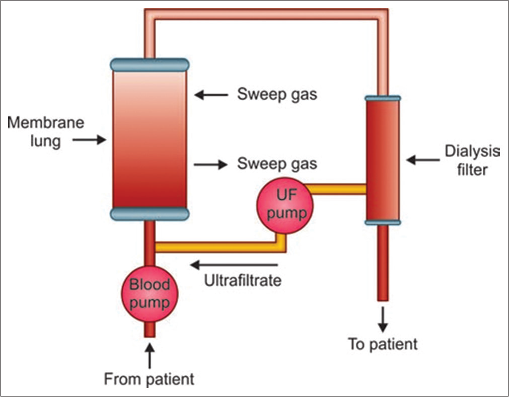 iLA Activve; circuit diagram.