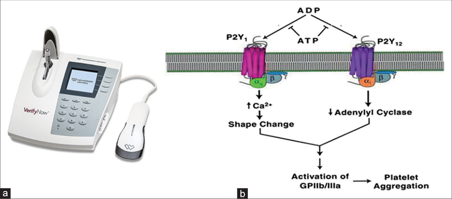 (a) The VerifyNow machine for high platelet reactivity and low platelet reactivity values. It shows a PRU results with cartridge use of the reagent to intubate the effect of antiplatelet drugs such as prasugrel or aspirin. (b) The VerifyNow device is fully automated and near platelet testing aggregation system, and is available solely for the monitoring of the three major classes of antiplatelet drugs (e.g., GPIIb/IIIa inhibitors, aspirin, and P2Y12 receptor inhibitors/antagonists).