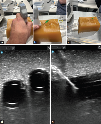 (a-c) Demonstrating image acquisition, access, and wire placement in synthetic model. (d and e) demonstrates ultrasound imaging in synthetic model.